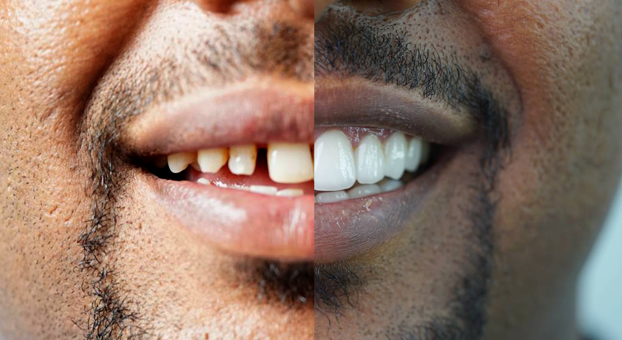 Service- 2 At Smile Specialty Dental Clinic, we create beautiful smiles.